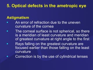 5. Optical defects in the ametropic eye Astigmatism An error of refraction due to the uneven curvature of the cornea The corneal surface is not spherical, so there is a meridian of least curvature and meridian of greatest curvature at right angle to the first Rays falling on the greatest curvature are focused earlier than those falling on the least curvature Correction is by the use of cylindrical lenses 