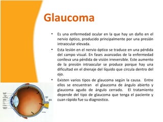 Glaucoma
 •   Es una enfermedad ocular en la que hay un daño en el
     nervio óptico, producido principalmente por una presión
     intraocular elevada.
 •   Esta lesión en el nervio óptico se traduce en una pérdida
     del campo visual. En fases avanzadas de la enfermedad
     conlleva una pérdida de visión irreversible. Este aumento
     de la presión intraocular se produce porque hay una
     dificultad en el drenaje del líquido que circula dentro del
     ojo.
 •   Existen varios tipos de glaucoma según la causa. Entre
     ellos se encuentran el glaucoma de ángulo abierto y
     glaucoma agudo de ángulo cerrado. El tratamiento
     depende del tipo de glaucoma que tenga el paciente y
     cuan rápido fue su diagnostico.
 