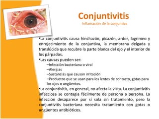 Conjuntivitis
                          Inflamación de la conjuntiva


•La conjuntivitis causa hinchazón, picazón, ardor, lagrimeo y
enrojecimiento de la conjuntiva, la membrana delgada y
translúcida que recubre la parte blanca del ojo y el interior de
los párpados.
•Las causas pueden ser:
    –Infección bacteriana o viral
    –Alergias
    –Sustancias que causan irritación
    –Productos que se usan para los lentes de contacto, gotas para
    los ojos o ungüentos.
•La conjuntivitis, en general, no afecta la vista. La conjuntivitis
infecciosa se contagia fácilmente de persona a persona. La
infección desaparece por sí sola sin tratamiento, pero la
conjuntivitis bacteriana necesita tratamiento con gotas o
ungüentos antibióticos.
 