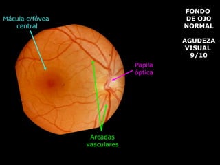 drpabloarias@hotmail.com
Fisiología de la Visión 37
AGUD
AGUDEZA VISUAL
FONDO
DE OJO
NORMAL
AGUDEZA
VISUAL
9/10
Papila
óptica
Arcadas
vasculares
Mácula c/fóvea
central
 