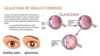 Anatomía y Fisiología del Ojo: Estructuras, Funciones y Patologías ...