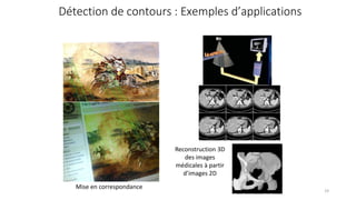 Mise en correspondance
Reconstruction 3D
des images
médicales à partir
d’images 2D
Détection de contours : Exemples d’applications
19
 