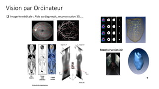 Reconstruction 3D
❑ Imagerie médicale : Aide au diagnostic, reconstruction 3D, …
7
Vision par Ordinateur
 