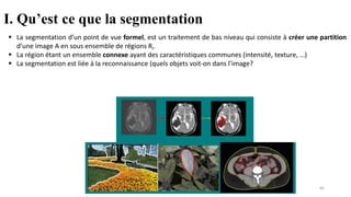 ▪ La segmentation d’un point de vue formel, est un traitement de bas niveau qui consiste à créer une partition
d’une image A en sous ensemble de régions Ri.
▪ La région étant un ensemble connexe ayant des caractéristiques communes (intensité, texture, …)
▪ La segmentation est liée à la reconnaissance (quels objets voit-on dans l’image?
I. Qu’est ce que la segmentation
85
 