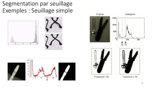 Segmentation par seuillage
Exemples : Seuillage simple
99
 