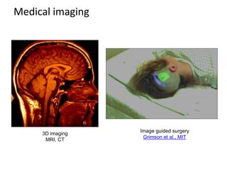 Medical imaging
Image guided surgery
Grimson et al., MIT
3D imaging
MRI, CT
 