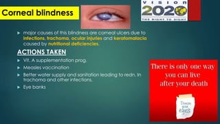 major causes of this blindness are corneal ulcers due to
infections, trachoma, ocular injuries and keratomalacia
caused by nutritional deficiencies.
ACTIONS TAKEN
 Vit. A supplementation prog.
 Measles vaccination
 Better water supply and sanitation leading to redn. In
trachoma and other infections.
 Eye banks
Corneal blindness
 