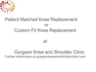 Patient Matched Knee Replacement
or
Custom Fit Knee Replacement
at
Gurgaon Knee and Shoulder Clinic
Further information at gurgaonkneeandshlolderclinic.com
 