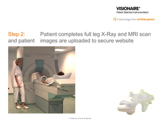 Step 3: Smith & Nephew engineer receives images via
secure website and design work begins on patient
matched instrumentati...