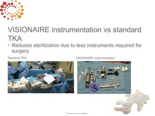VISIONAIRE instrumentation vs standard
TKA
• Eliminates need to violate the intramedullary canal,
reducing blood loss and ...