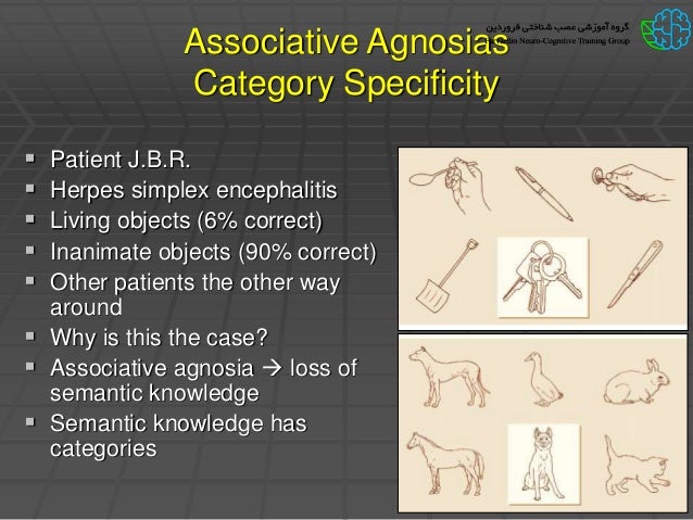 Vision and agnosias Vision and agnosias