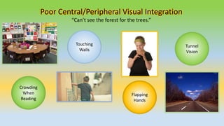 Crowding
When
Reading
Touching
Walls
Flapping
Hands
Tunnel
Vision
Poor Central/Peripheral Visual Integration
“Can’t see the forest for the trees.”
 