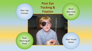Poor
Tracking of
Print
Poor Eye
Contact
Short
Attention
Span
Poor Visual
Detail
Poor Eye
Tracking &
Fixation
 