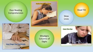 Head Tilt
Skips
Lines
Poor Reading
Comprehension
Misaligns
Columns of
Digits
Uses Finger Past 2nd Grade
Holds Book Too Close
Uses One Eye
 