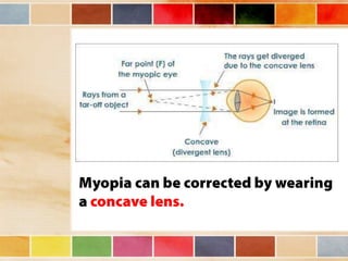 Vision and optical instruments