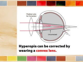 Vision and optical instruments