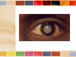 Vision and optical instruments