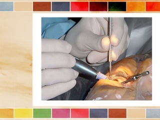 Vision and optical instruments