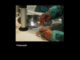 Preparação