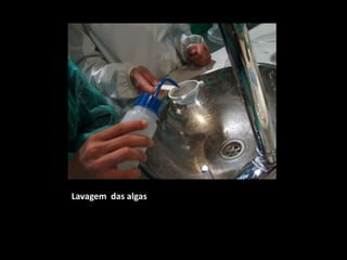 Lavagem  das algas