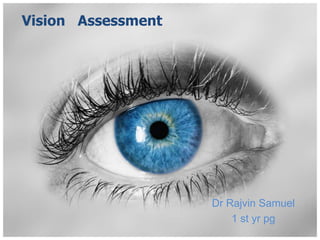 Vision Assessment
Dr Rajvin Samuel
1 st yr pg
 