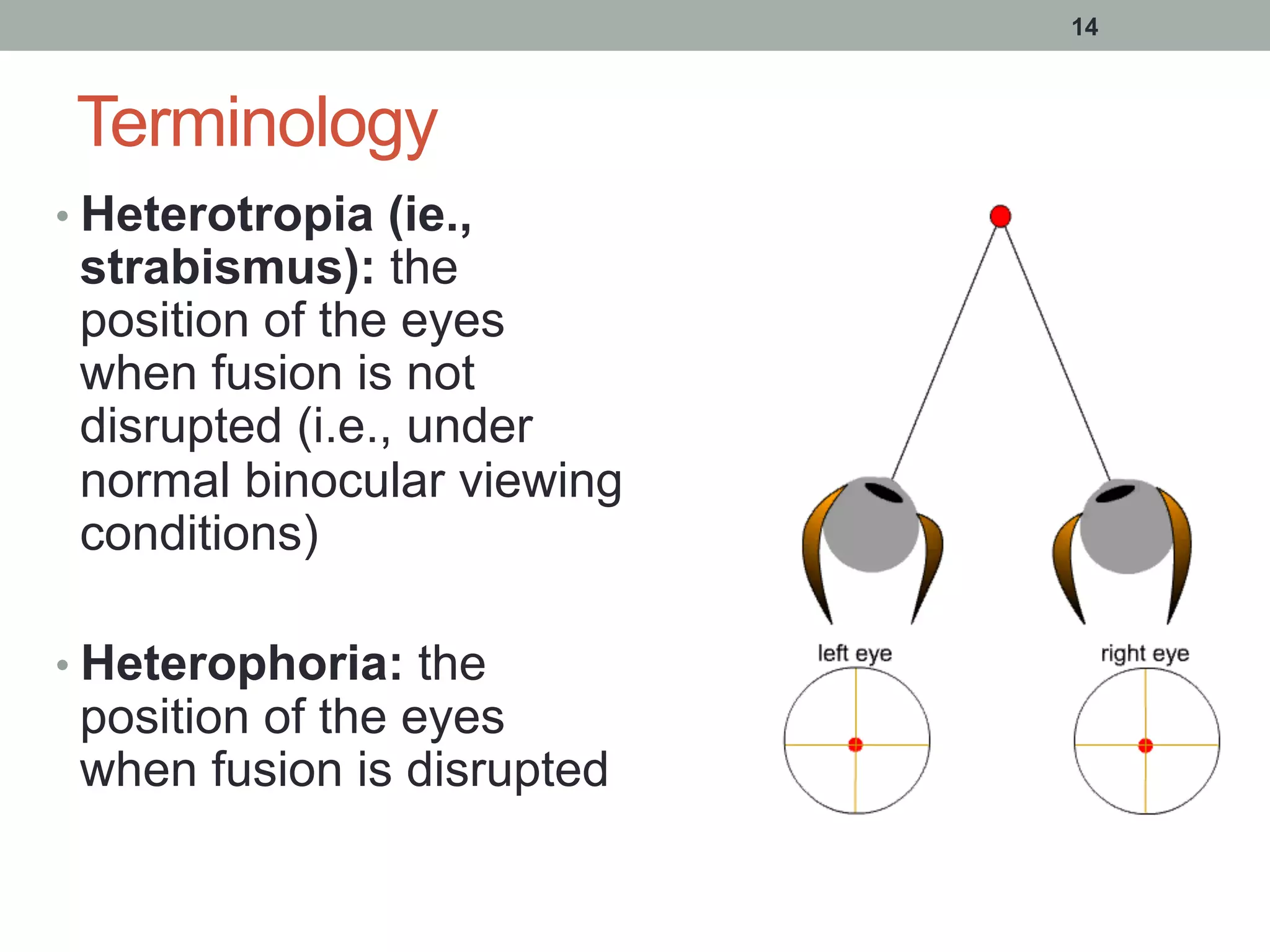 Terminology
• Heterotropia (ie.,
strabismus): the
position of the eyes
when fusion is not
disrupted (i.e., under
normal binocular viewing
conditions)
• Heterophoria: the
position of the eyes
when fusion is disrupted
14
 