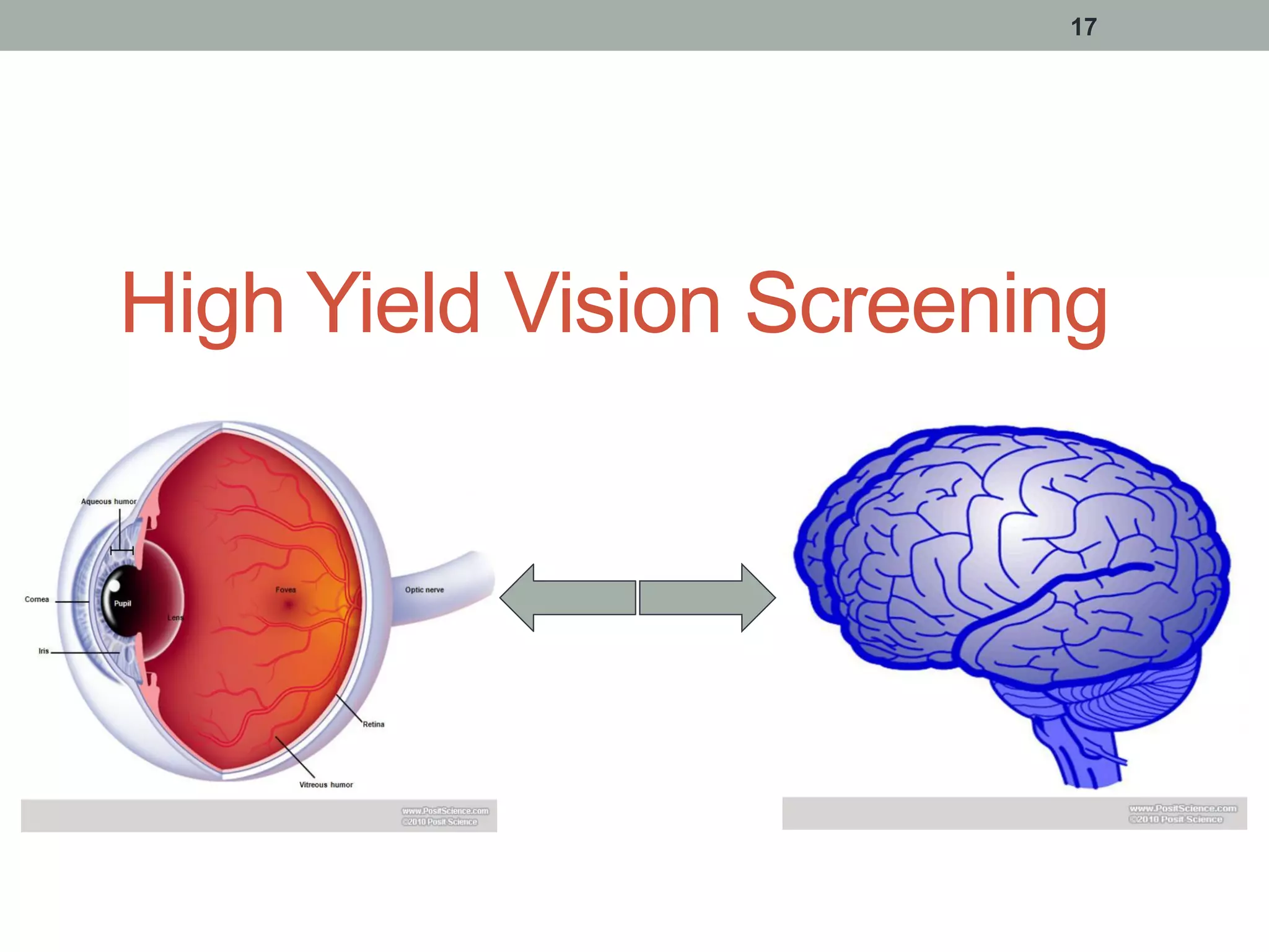 17
High Yield Vision Screening
 