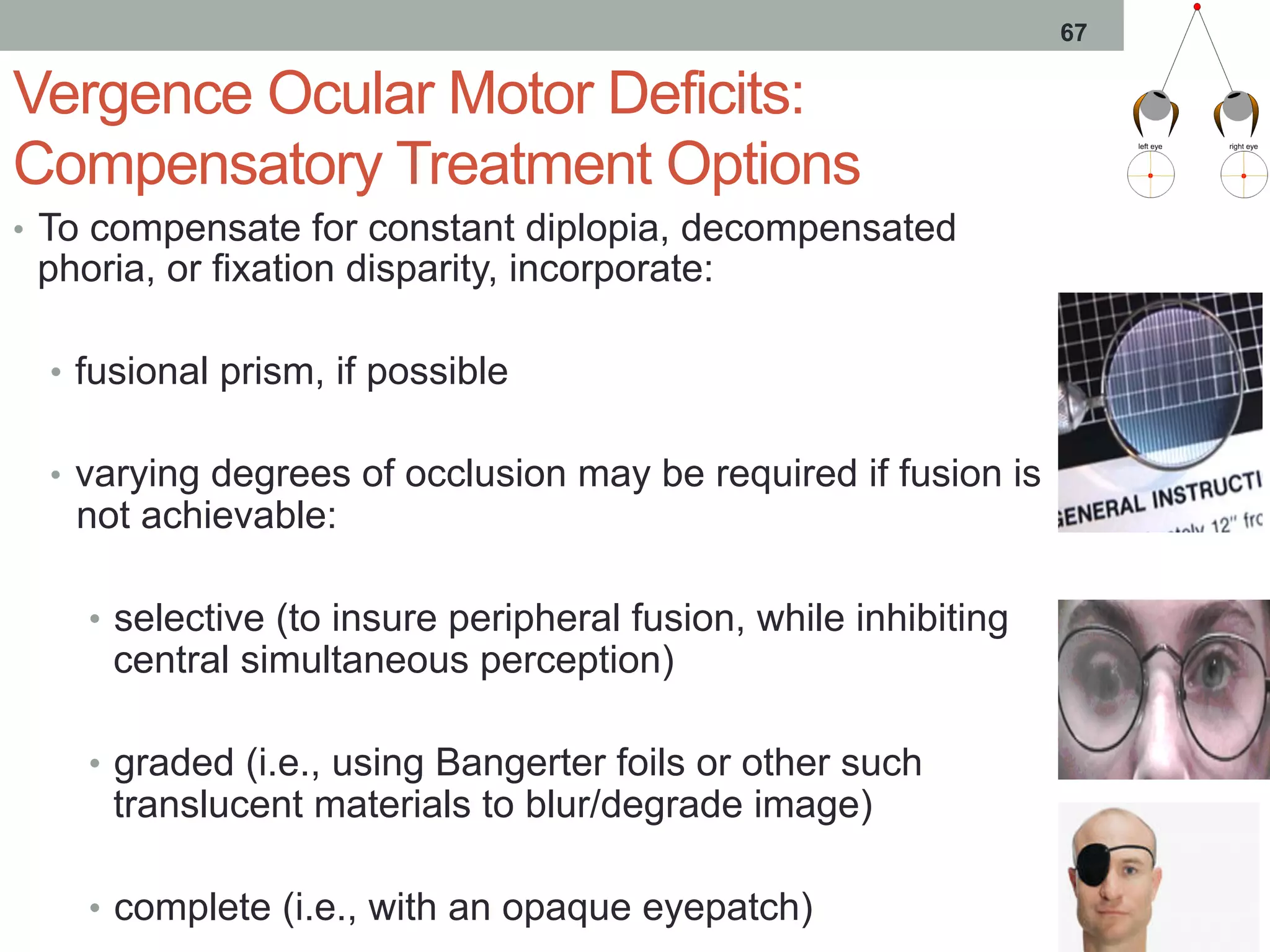 67
Vergence Ocular Motor Deficits:
Compensatory Treatment Options
•  To compensate for constant diplopia, decompensated
phoria, or fixation disparity, incorporate:
•  fusional prism, if possible
•  varying degrees of occlusion may be required if fusion is
not achievable:
•  selective (to insure peripheral fusion, while inhibiting
central simultaneous perception)
•  graded (i.e., using Bangerter foils or other such
translucent materials to blur/degrade image)
•  complete (i.e., with an opaque eyepatch)
 