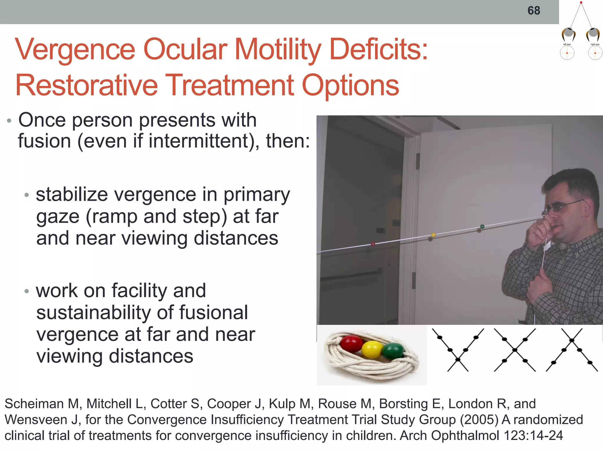 Vergence Ocular Motility Deficits:
Restorative Treatment Options
•  Once person presents with
fusion (even if intermittent), then:
•  stabilize vergence in primary
gaze (ramp and step) at far
and near viewing distances
•  work on facility and
sustainability of fusional
vergence at far and near
viewing distances
68
Scheiman M, Mitchell L, Cotter S, Cooper J, Kulp M, Rouse M, Borsting E, London R, and
Wensveen J, for the Convergence Insufficiency Treatment Trial Study Group (2005) A randomized
clinical trial of treatments for convergence insufficiency in children. Arch Ophthalmol 123:14-24
 