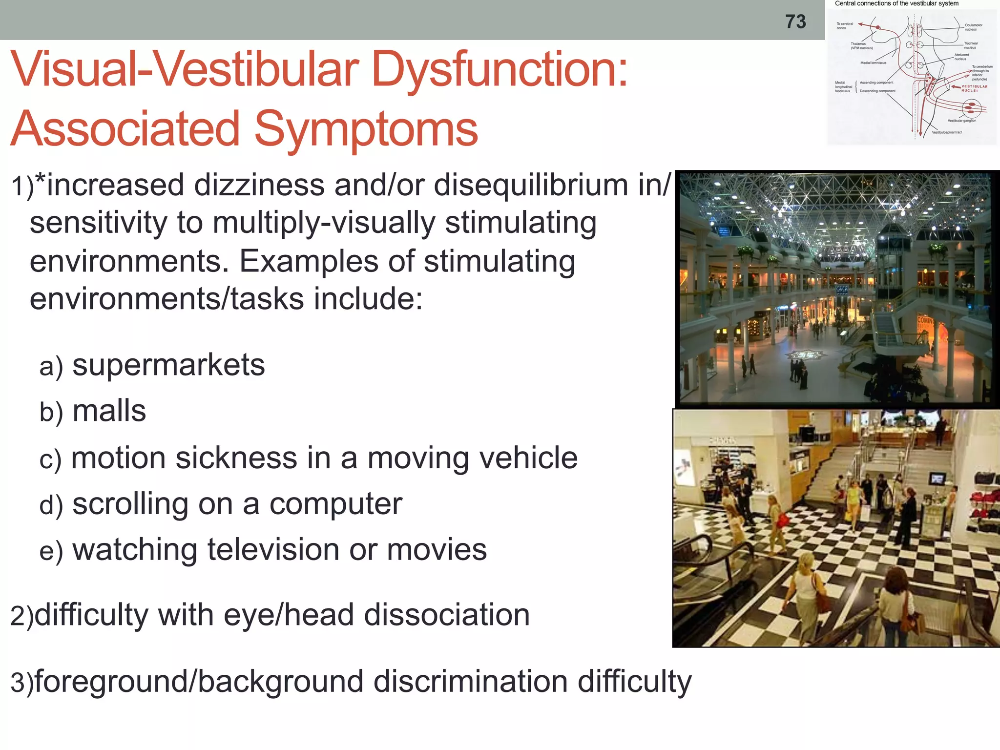 Visual-Vestibular Dysfunction:
Associated Symptoms
1) *increased dizziness and/or disequilibrium in/
sensitivity to multiply-visually stimulating
environments. Examples of stimulating
environments/tasks include:
a)  supermarkets
b)  malls
c)  motion sickness in a moving vehicle
d)  scrolling on a computer
e)  watching television or movies
2) difficulty with eye/head dissociation
3) foreground/background discrimination difficulty
73
 
