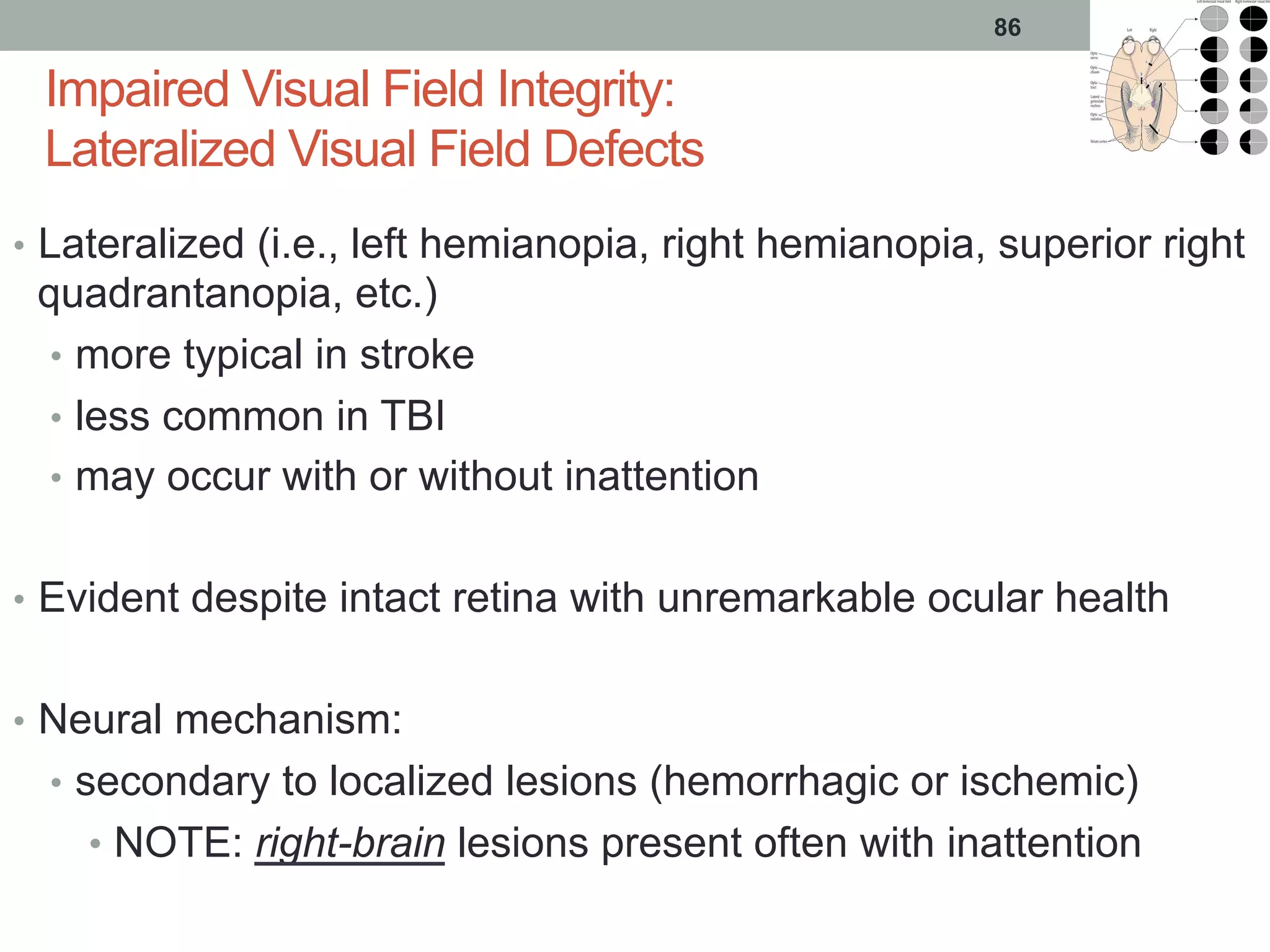 Impaired Visual Field Integrity:
Lateralized Visual Field Defects
•  Lateralized (i.e., left hemianopia, right hemianopia, superior right
quadrantanopia, etc.)
•  more typical in stroke
•  less common in TBI
•  may occur with or without inattention
•  Evident despite intact retina with unremarkable ocular health
•  Neural mechanism:
•  secondary to localized lesions (hemorrhagic or ischemic)
•  NOTE: right-brain lesions present often with inattention
86
 