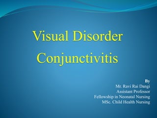 Visual Disorder
Conjunctivitis
By
Mr. Ravi Rai Dangi
Assistant Professor
Fellowship in Neonatal Nursing
MSc. Child Health Nursing
 