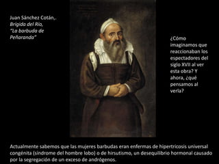 Juan Sánchez Cotán,.
Brígida del Río,
“La barbuda de
Peñaranda”                                                           ¿Cómo
                                                                     imaginamos que
                                                                     reaccionaban los
                                                                     espectadores del
                                                                     siglo XVII al ver
                                                                     esta obra? Y
                                                                     ahora, ¿qué
                                                                     pensamos al
                                                                     verla?




Actualmente sabemos que las mujeres barbudas eran enfermas de hipertricosis universal
congénita (síndrome del hombre lobo) o de hirsutismo, un desequilibrio hormonal causado
por la segregación de un exceso de andrógenos.
 