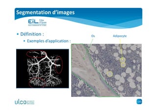 135
AdipocyteOs
Segmentation d’images
• Définition :
• Exemples d’application :
 