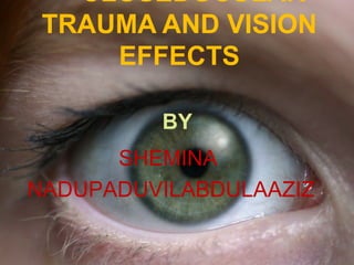 CLOSEDOCULAR
TRAUMA AND VISION
EFFECTS
BY
SHEMINA
NADUPADUVILABDULAAZIZ
 