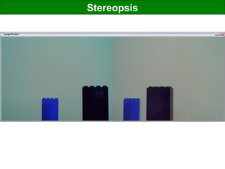 Stereopsis
 