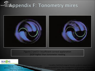 physiology of vision | PPT