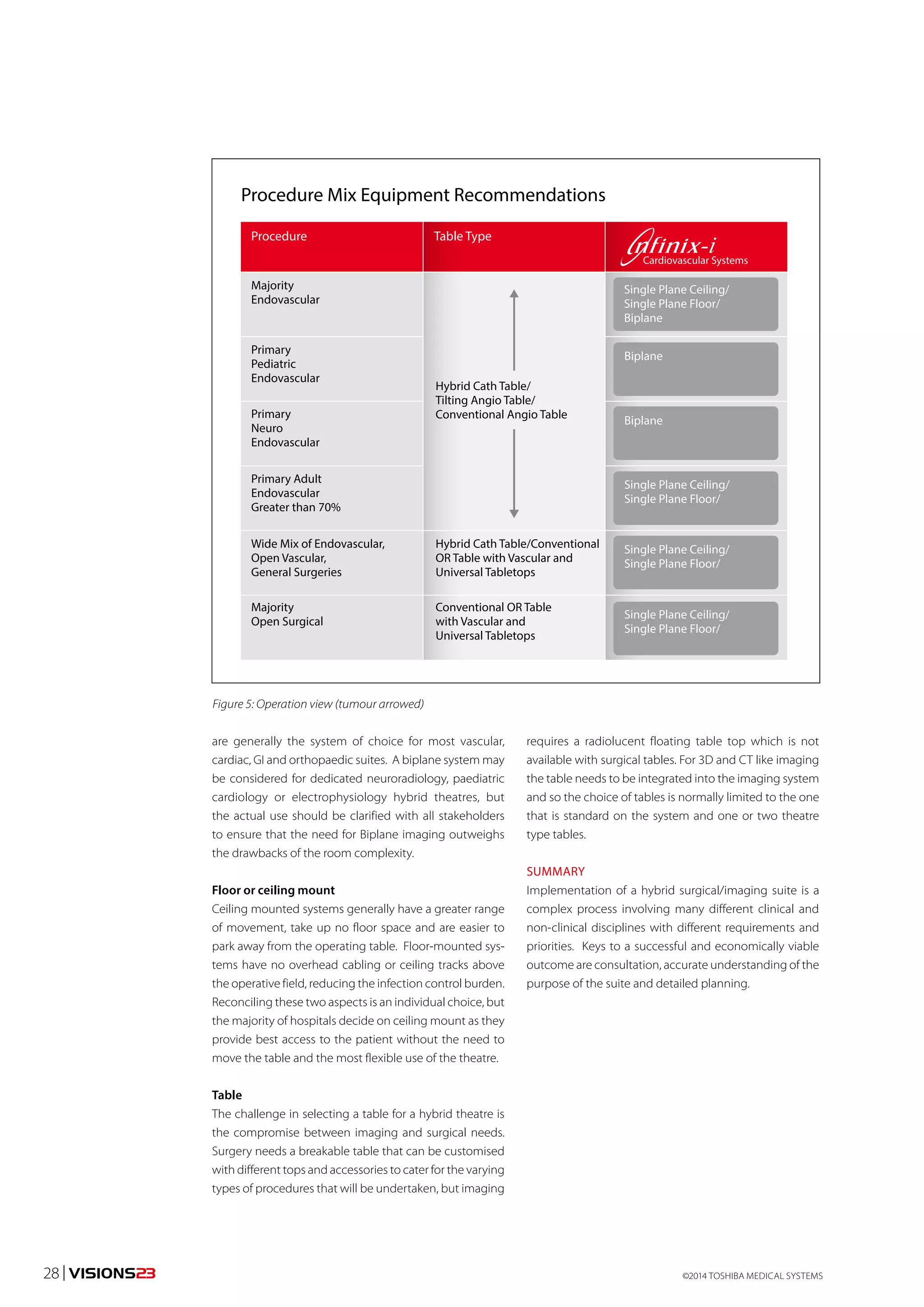 Procedure Mix Equipment Recommendations 
Procedure 
Majority 
Endovascular 
Primary 
Pediatric 
Endovascular 
Primary 
Neuro 
Endovascular 
Primary Adult 
Endovascular 
Greater than 70% 
Wide Mix of Endovascular, 
Open Vascular, 
General Surgeries 
Majority 
Open Surgical 
Table Type 
Hybrid Cath Table/ 
Tilting Angio Table/ 
Conventional Angio Table 
Hybrid Cath Table/Conventional 
OR Table with Vascular and 
Universal Tabletops 
Conventional OR Table 
with Vascular and 
Universal Tabletops 
Figure 5: Operation view (tumour arrowed) 
are generally the system of choice for most vascular, 
cardiac, GI and orthopaedic suites. A biplane system may 
be considered for dedicated neuroradiology, paediatric 
cardiology or electrophysiology hybrid theatres, but 
the actual use should be clarified with all stakeholders 
to ensure that the need for Biplane imaging outweighs 
the drawbacks of the room complexity. 
Floor or ceiling mount 
Ceiling mounted systems generally have a greater range 
of movement, take up no floor space and are easier to 
park away from the operating table. Floor-mounted sys-tems 
have no overhead cabling or ceiling tracks above 
the operative field, reducing the infection control burden. 
Reconciling these two aspects is an individual choice, but 
the majority of hospitals decide on ceiling mount as they 
provide best access to the patient without the need to 
move the table and the most flexible use of the theatre. 
Table 
The challenge in selecting a table for a hybrid theatre is 
the compromise between imaging and surgical needs. 
Surgery needs a breakable table that can be customised 
with different tops and accessories to cater for the varying 
types of procedures that will be undertaken, but imaging 
Cardiovascular Systems 
Single Plane Ceiling/ 
Single Plane Floor/ 
Biplane 
Biplane 
Biplane 
Single Plane Ceiling/ 
Single Plane Floor/ 
Single Plane Ceiling/ 
Single Plane Floor/ 
Single Plane Ceiling/ 
Single Plane Floor/ 
requires a radiolucent floating table top which is not 
available with surgical tables. For 3D and CT like imaging 
the table needs to be integrated into the imaging system 
and so the choice of tables is normally limited to the one 
that is standard on the system and one or two theatre 
type tables. 
SUMMARY 
Implementation of a hybrid surgical/imaging suite is a 
complex process involving many different clinical and 
non-clinical disciplines with different requirements and 
priorities. Keys to a successful and economically viable 
outcome are consultation, accurate understanding of the 
purpose of the suite and detailed planning. 
©2014 28 | VISIONS23 TOSHIBA MEDICAL SYSTEMS 
 