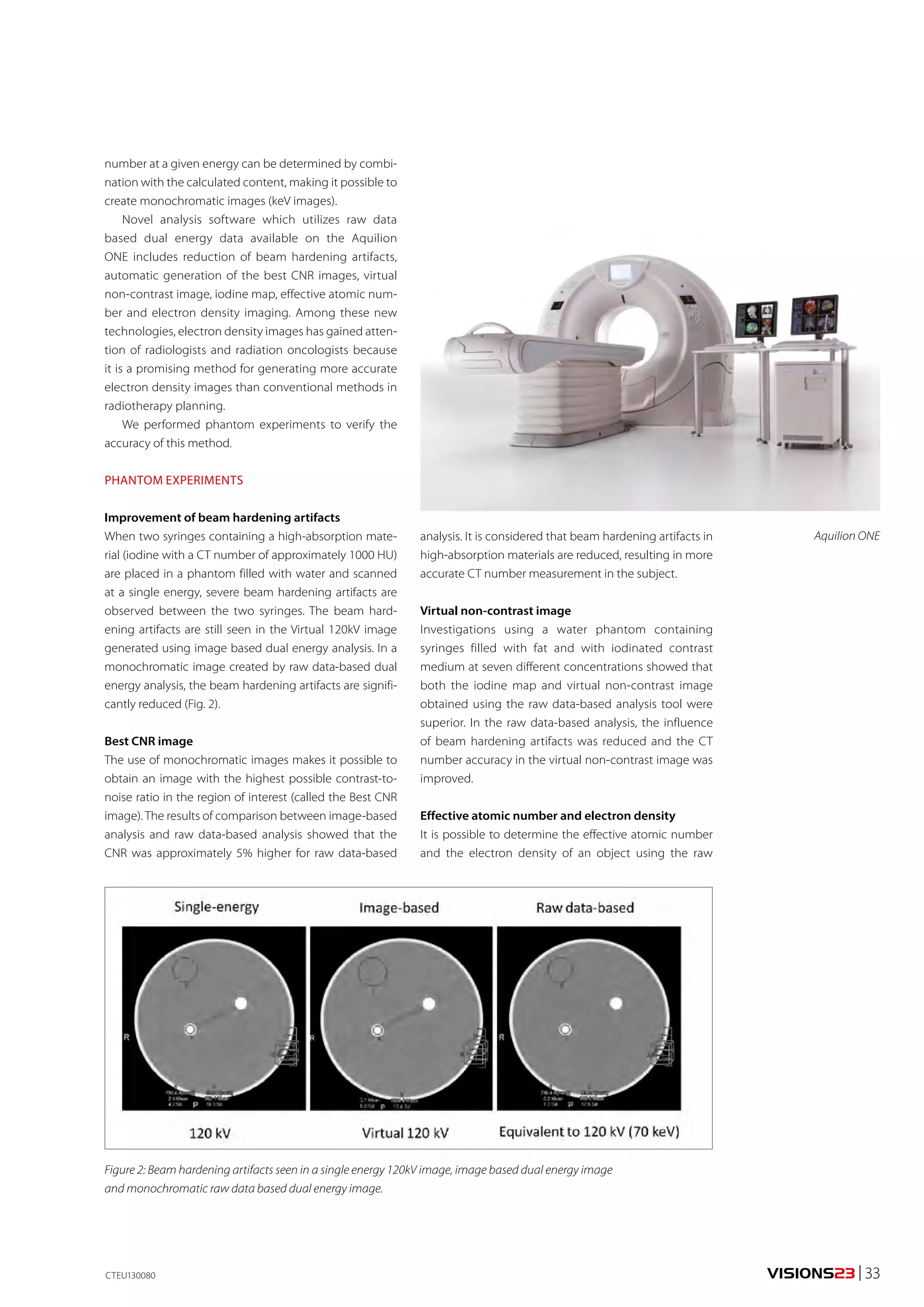number at a given energy can be determined by combi-nation 
with the calculated content, making it possible to 
create monochromatic images (keV images). 
Novel analysis software which utilizes raw data 
based dual energy data available on the Aquilion 
ONE includes reduction of beam hardening artifacts, 
automatic generation of the best CNR images, virtual 
non-contrast image, iodine map, effective atomic num-ber 
and electron density imaging. Among these new 
technologies, electron density images has gained atten-tion 
of radiologists and radiation oncologists because 
it is a promising method for generating more accurate 
electron density images than conventional methods in 
radiotherapy planning. 
We performed phantom experiments to verify the 
accuracy of this method. 
PHANTOM EXPERIMENTS 
Improvement of beam hardening artifacts 
When two syringes containing a high-absorption mate-rial 
(iodine with a CT number of approximately 1000 HU) 
are placed in a phantom filled with water and scanned 
at a single energy, severe beam hardening artifacts are 
observed between the two syringes. The beam hard-ening 
artifacts are still seen in the Virtual 120kV image 
generated using image based dual energy analysis. In a 
monochromatic image created by raw data-based dual 
energy analysis, the beam hardening artifacts are signifi-cantly 
reduced (Fig. 2). 
Best CNR image 
The use of monochromatic images makes it possible to 
obtain an image with the highest possible contrast-to-noise 
ratio in the region of interest (called the Best CNR 
image). The results of comparison between image-based 
analysis and raw data-based analysis showed that the 
CNR was approximately 5% higher for raw data-based 
analysis. It is considered that beam hardening artifacts in 
high-absorption materials are reduced, resulting in more 
accurate CT number measurement in the subject. 
Virtual non-contrast image 
Investigations using a water phantom containing 
syringes filled with fat and with iodinated contrast 
medium at seven different concentrations showed that 
both the iodine map and virtual non-contrast image 
obtained using the raw data-based analysis tool were 
superior. In the raw data-based analysis, the influence 
of beam hardening artifacts was reduced and the CT 
number accuracy in the virtual non-contrast image was 
improved. 
Effective atomic number and electron density 
It is possible to determine the effective atomic number 
and the electron density of an object using the raw 
Figure 2: Beam hardening artifacts seen in a single energy 120kV image, image based dual energy image 
and monochromatic raw data based dual energy image. 
Aquilion ONE 
CTEU130080 VISIONS23 | 33 
 