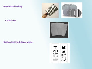 Preferential Looking Test Examples Vision screening in children by Hala Fathi Hannot | PPTX