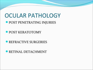 OCULAR PATHOLOGY
POST PENETRATING INJURIES
POST KERATOTOMY
REFRACTIVE SURGERIES
RETINAL DETACHMENT
 