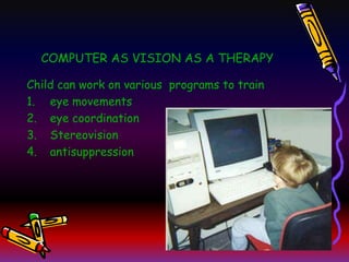 Vision therapy arya | PPT