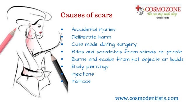 Tattoos deals in noida