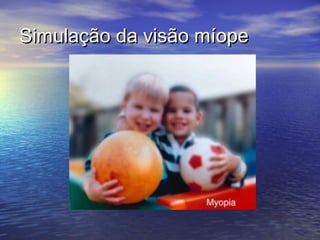 Simulação da visão míope
 