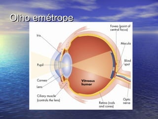Olho emétrope
 