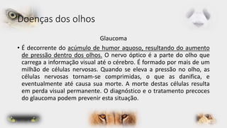 Doenças dos olhos 
Glaucoma 
• É decorrente do acúmulo de humor aquoso, resultando do aumento 
de pressão dentro dos olhos. O nervo óptico é a parte do olho que 
carrega a informação visual até o cérebro. É formado por mais de um 
milhão de células nervosas. Quando se eleva a pressão no olho, as 
células nervosas tornam-se comprimidas, o que as danifica, e 
eventualmente até causa sua morte. A morte destas células resulta 
em perda visual permanente. O diagnóstico e o tratamento precoces 
do glaucoma podem prevenir esta situação. 
 