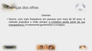 Doenças dos olhos 
Catarata 
• Ocorre, com mais frequência em pessoas com mais de 50 anos. A 
catarata prejudica a visão porque o cristalino perde parte da sua 
transparência. O tratamento geralmente é cirúrgico. 
 