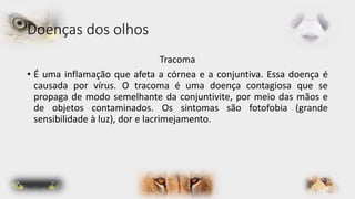 Doenças dos olhos 
Tracoma 
• É uma inflamação que afeta a córnea e a conjuntiva. Essa doença é 
causada por vírus. O tracoma é uma doença contagiosa que se 
propaga de modo semelhante da conjuntivite, por meio das mãos e 
de objetos contaminados. Os sintomas são fotofobia (grande 
sensibilidade à luz), dor e lacrimejamento. 
 
