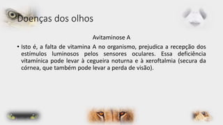 Doenças dos olhos 
Avitaminose A 
• Isto é, a falta de vitamina A no organismo, prejudica a recepção dos 
estímulos luminosos pelos sensores oculares. Essa deficiência 
vitamínica pode levar à cegueira noturna e à xeroftalmia (secura da 
córnea, que também pode levar a perda de visão). 
 
