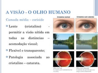 A VISÃO - O OLHO HUMANO 
Camada média – corioide 
 Lente (cristalino) - 
permitir a visão nítida em 
todas as distâncias – 
acomodação visual; 
 Flexível e transparente; 
 Patologia associada ao 
cristalino – catarata. 
 